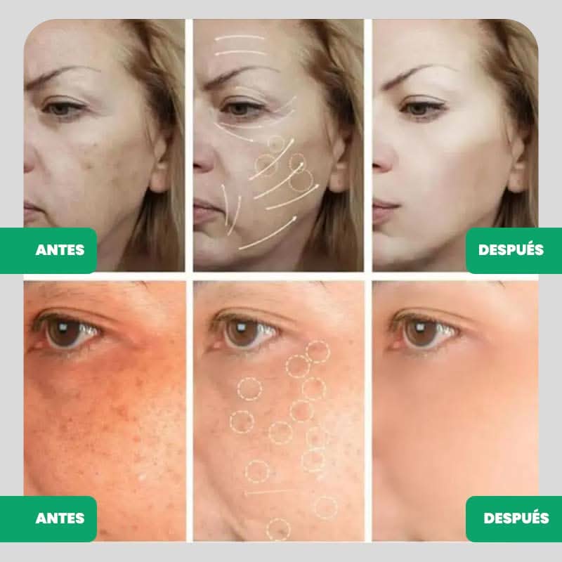 Suero Blanqueador con Ácido kójico