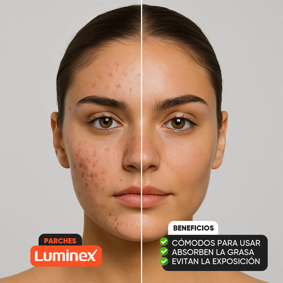 Pack de 48 Parches Anti-Acne Circulares Luminex