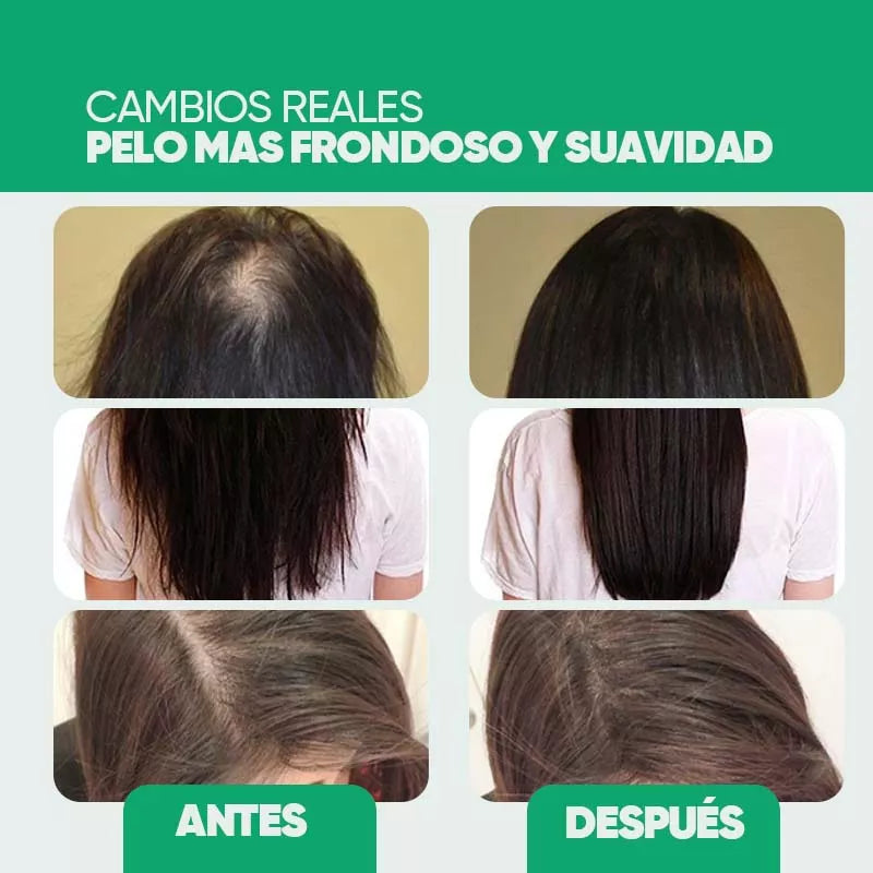 Aceite Natural para el Crecimiento del Cabello Eelhoe