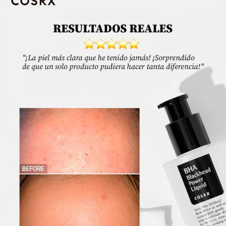BHA BLACKHEAD POWER LIQUID COSRX - Exfoliante químico