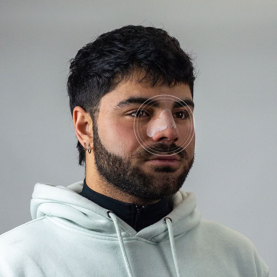 Pack de 10 Parches Anti-Acne para Nariz Luminex