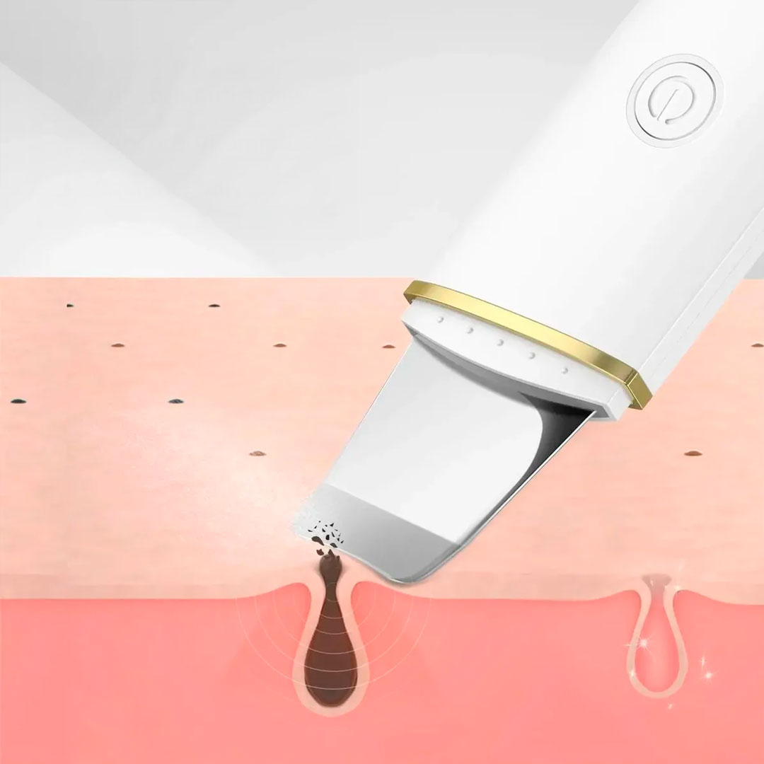 Espátula Facial Ultrasónica Limpieza Profunda Portátil