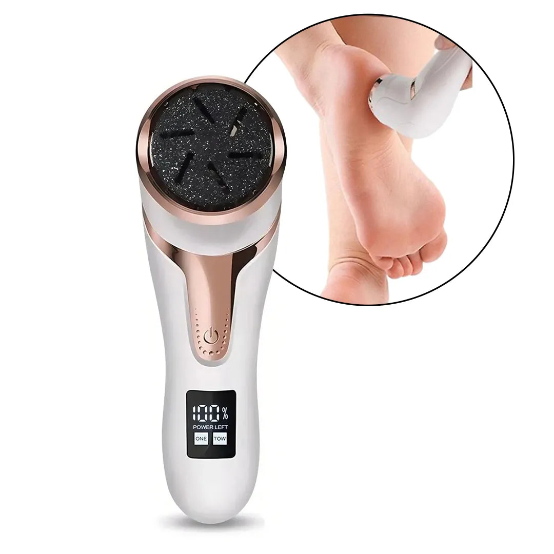 Removedor de Callos y Exfoliador de Pies Calidad Superior