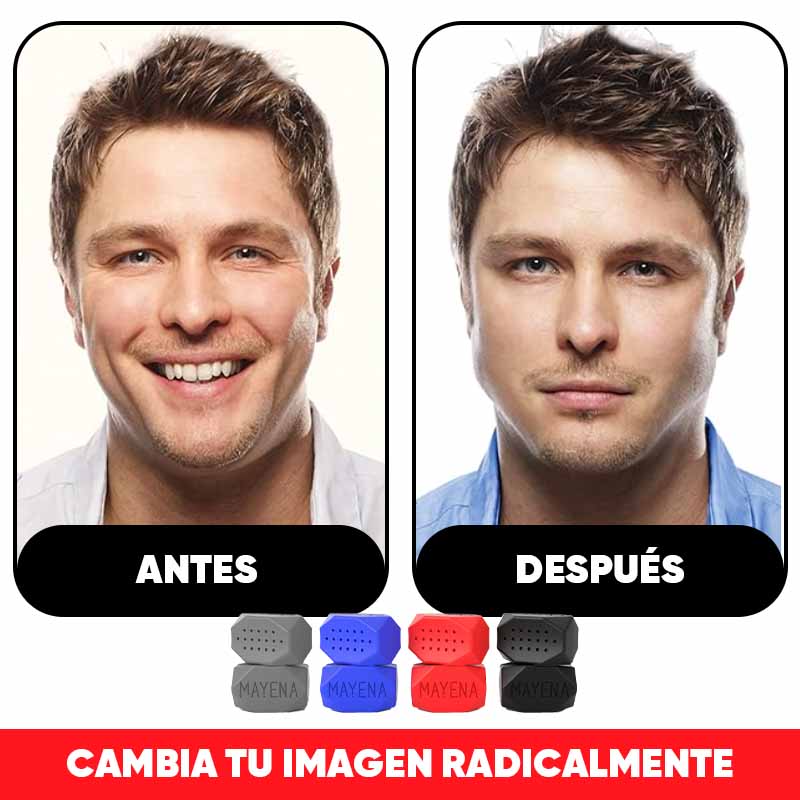 Ejercitador de Mandíbula con 3 Niveles de Resisitencia