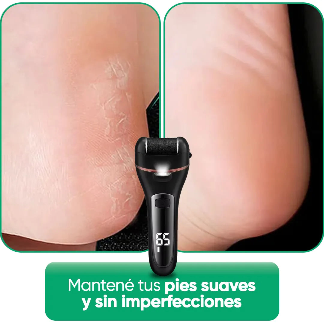 Removedor de Callos y Piel Dura Premium