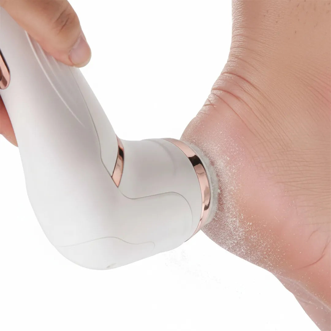 Removedor de Callos y Exfoliador de Pies Calidad Superior