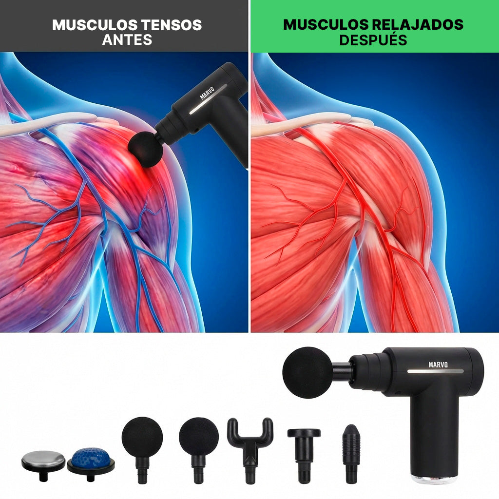 Pistola Masajeadora Marvo PMS-010 Inalámbrica