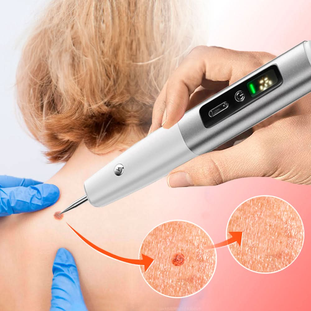 Lapiz Cauterizador de Plasma para Eliminar Manchas