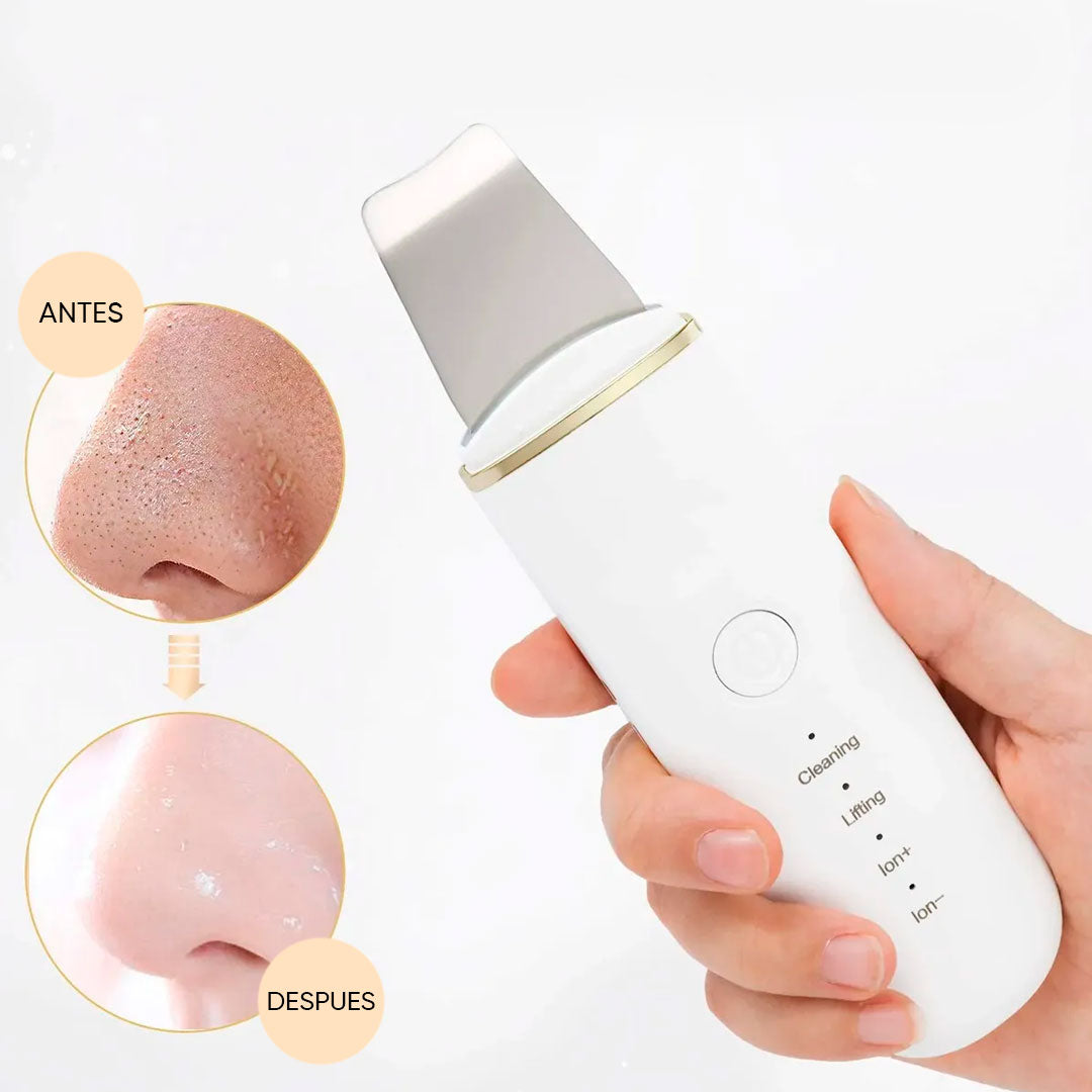 Espátula Facial Ultrasónica Limpieza Profunda Portátil